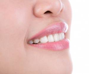 زیبایی دندان با کامپوزیت ؛ هر آنچه باید بدانید